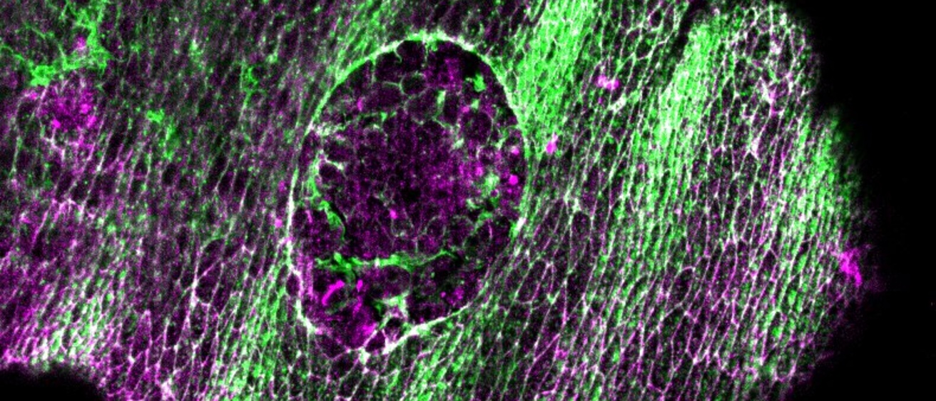 fly embryo with wound stained for cytoskeleton in green and cell adhesion in magenta